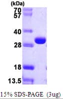 E. coli deoC Protein (Recombinant His)