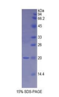 Rat TNC / Tenascin C Protein (Recombinant His, N-Terminal)