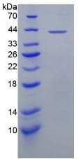 Human OXTR / Oxytocin Receptor Protein (Recombinant His-GST, N-terminus)