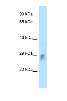 Polyclonal Rabbit anti-Mouse ARHU / RHOU Antibody (aa41-90, WB)