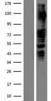 Human PAK1 Protein (Over-Expression Lysate Myc-DDK (Flag))