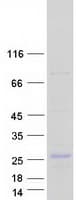 Human ERBB3 / HER3 Protein (Recombinant Myc-DDK (Flag))