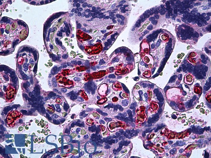 PathPlus™ FGF1 / Acidic FGF Antibody (clone 2E12)