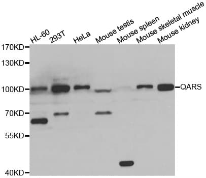 Polyclonal Rabbit anti-Human GLNRS / QARS Antibody (IHC, IF, WB)