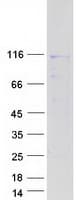 Human NAA25 Protein (Recombinant Myc-DDK (Flag))