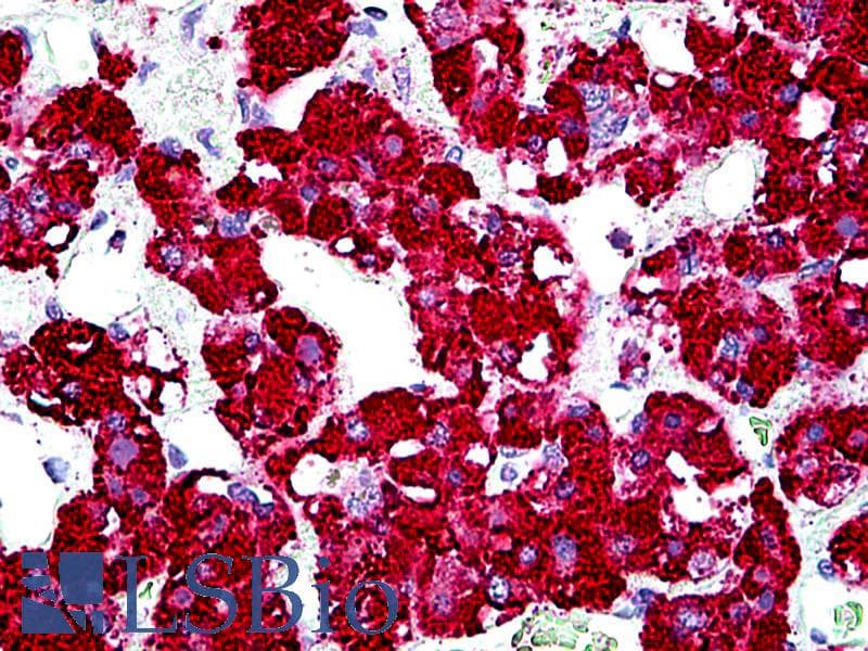 IHC-plus™ Polyclonal Goat anti-Human GPER1 / GPR30 Antibody (aa357-370, IHC)