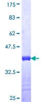 Human FLNB / TAP Protein (Recombinant GST, N-terminus)