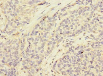 Polyclonal Rabbit anti-Human CD276 / B7-H3 Antibody (IHC)