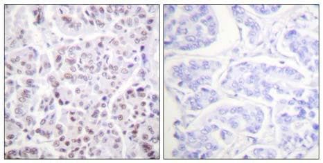 Polyclonal Rabbit anti-Human Histone H4 Antibody (Acetyl-Lys5, IHC, IF, WB)