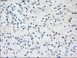 SSX2 Antibody (clone OTI4A11)