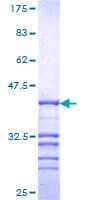 Human N-CoR / NCOR1 Protein (Recombinant GST, N-terminus)