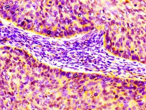 Polyclonal Rabbit anti-Human CCL17 / TARC Antibody (IHC)