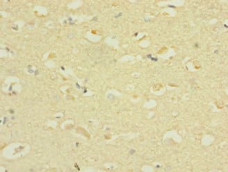 SCN3A / Nav1.3 Antibody