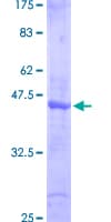 Human SMAD6 Protein (Recombinant GST, N-terminus)