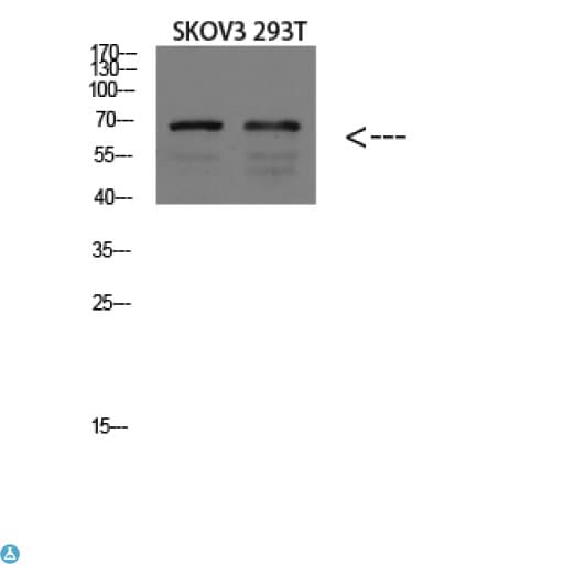 Polyclonal Rabbit anti-Human PPP1R15A / GADD34 Antibody (WB)