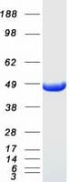 Human VAT1 Protein (Recombinant Myc-DDK (Flag))