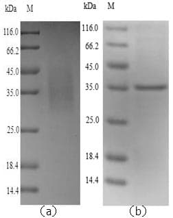 Mouse LGMN / Legumain Protein (Recombinant 6His, N-terminus)