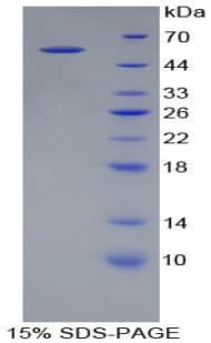 Human BMP1 Protein (Recombinant His-GST)