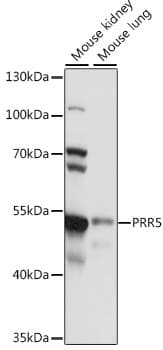 PRR5 Antibody