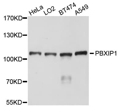 PBXIP1 / HPIP Antibody