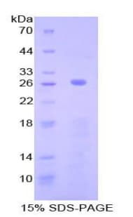 Human Complement C2 Protein (Recombinant His-T7)