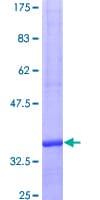Human CXCL1 / GRO Alpha Protein (Recombinant GST)