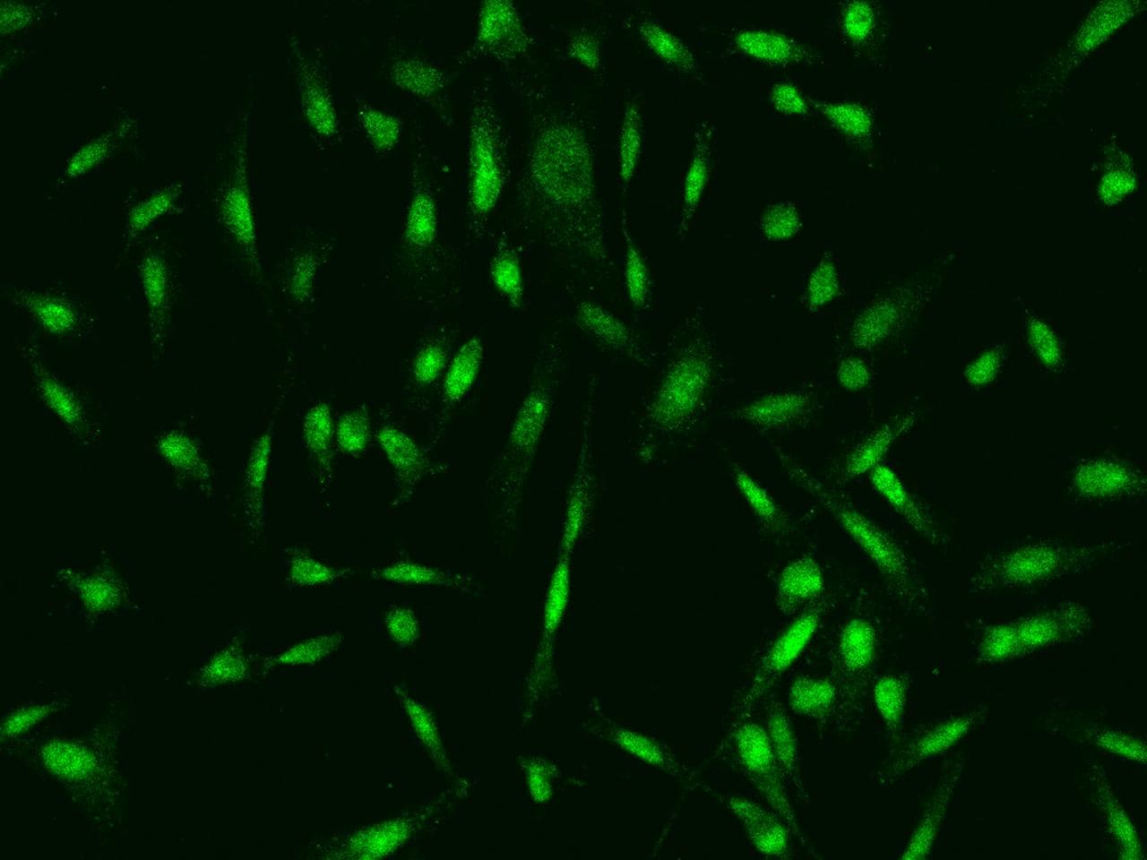 Aprataxin / APTX Antibody