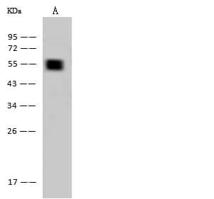 KRT7 / CK7 / Cytokeratin 7 Antibody (clone 005, Preservative Free)