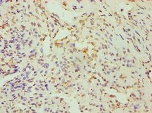 Polyclonal Rabbit anti-Human CRY1 Antibody (aa507-586, IHC)