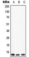 Polyclonal Rabbit anti-Human APOC2 / Apolipoprotein C II Antibody (Internal, WB)