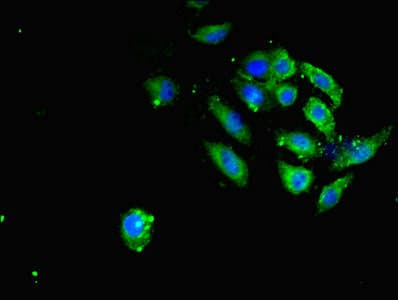 SAV1 / WW45 Antibody