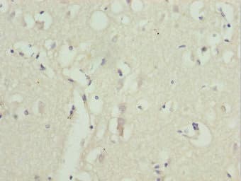 ZNF264 Antibody