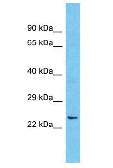 LDLRAD2 Antibody (aa130-179)