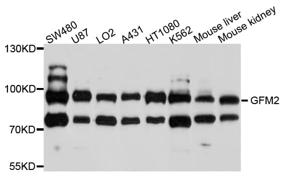 Polyclonal Rabbit anti-Human GFM2 Antibody (WB)