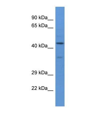 NELFA / WHSC2 Antibody (aa247-296)