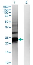 HDHD1 Antibody (clone 4F12)