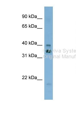 GTF2H2 Antibody (aa323-372)