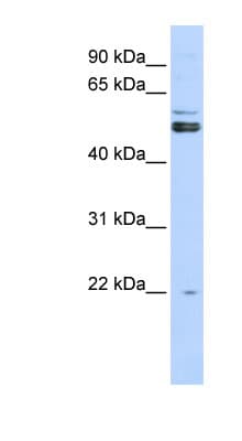 Polyclonal Rabbit anti-Human PRMT2 Antibody (aa71-120, WB)