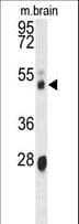 CYP3A43 Antibody (aa242-270)