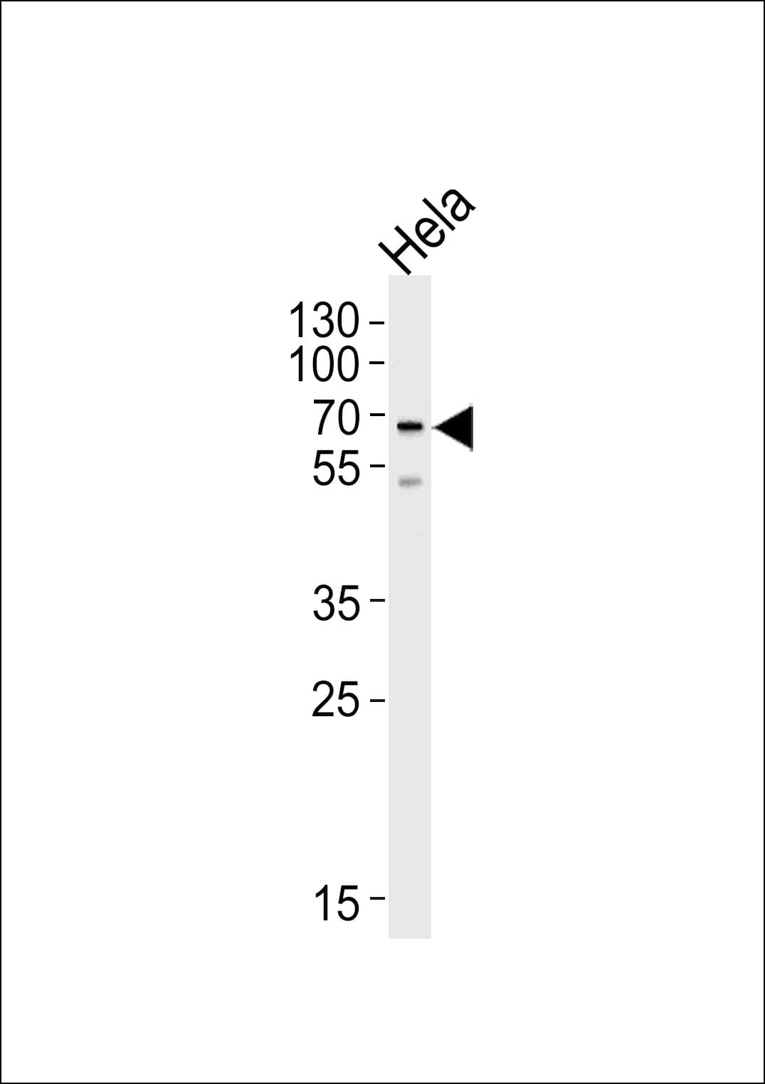 NAP1L2 / BPX Antibody (aa113-139)
