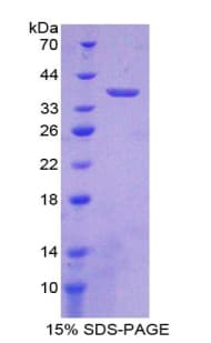 Mouse LDHB / Lactate Dehydrogenase B Protein (Recombinant His)