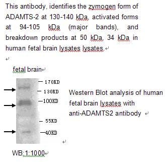 ADAMTS2 Antibody (aa1150-1211)