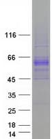 Human BMP6 Protein (Recombinant Myc-DDK (Flag))