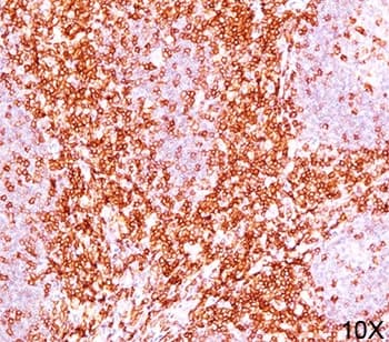 CD6 Antibody (clone C6/372 + 3F7B5, Ready-to-Use)