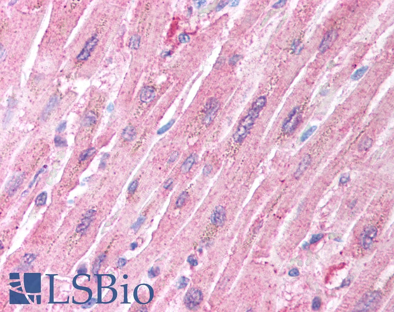 IHC-plus™ Polyclonal Rabbit anti-Human CRADD / RAIDD Antibody (IHC, IF, WB)