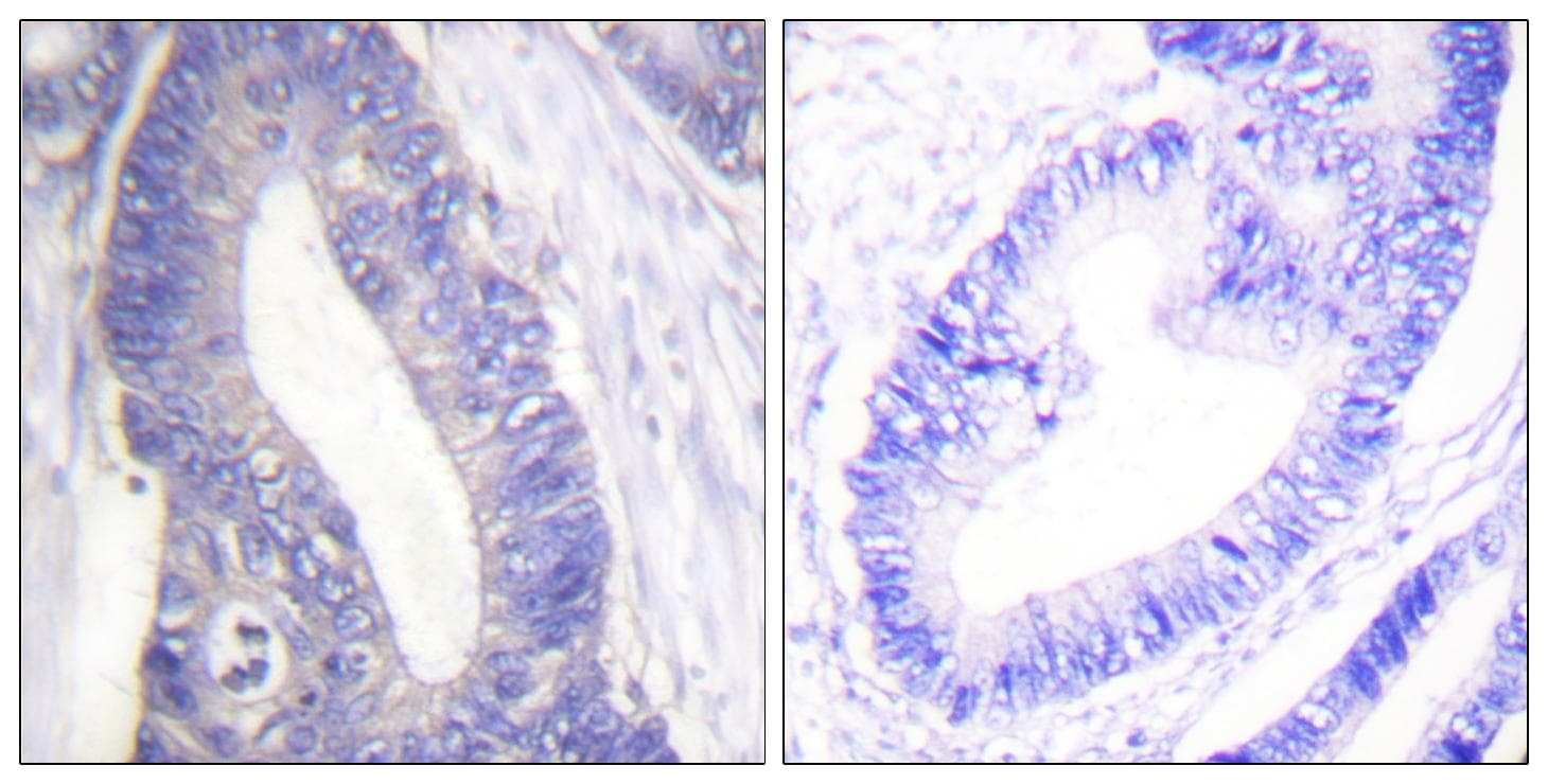 Polyclonal Rabbit anti-Human IRS1 Antibody (IHC)
