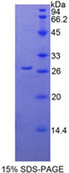 Mouse CYR61 Protein (Recombinant His-T7)