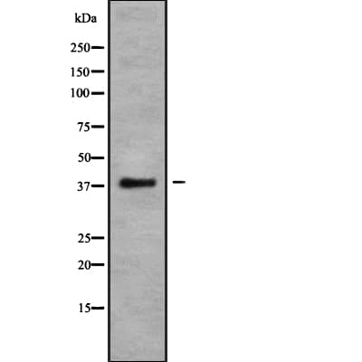 CCR10 / GPR2 Antibody
