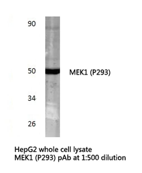 Polyclonal Rabbit anti-Human MAP2K1 / MKK1 / MEK1 Antibody (Pro293, IHC, WB)