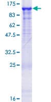 Human OPHN1 Protein (Recombinant GST)